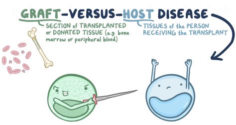 Graft vs. Host Disease (GvHD) .